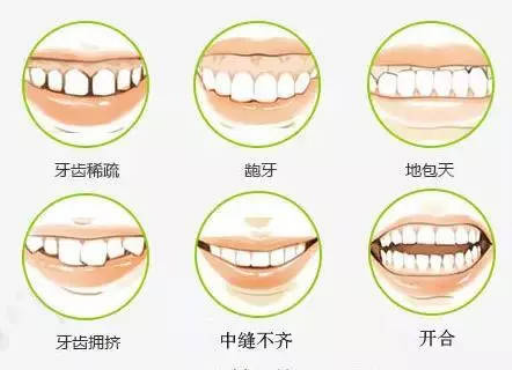 窝沟封闭什么时候什么人做,窝沟封闭效果评价方法(图1)